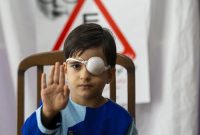 غربالگری تنبلی چشم برای کودکان، کجا و چگونه انجام می‌شود؟